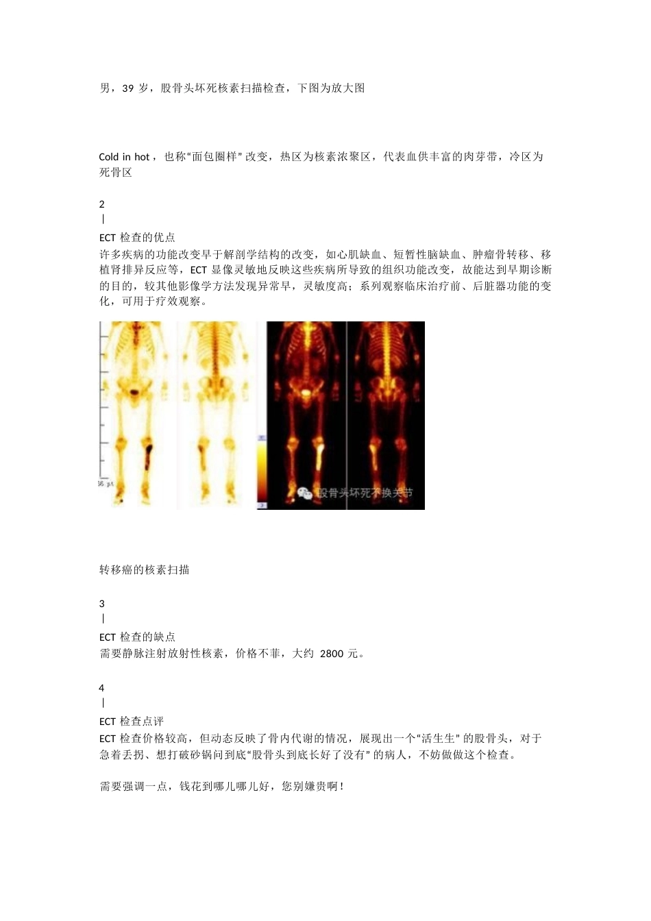 股骨头坏死应该怎样做检查(2)_第13页