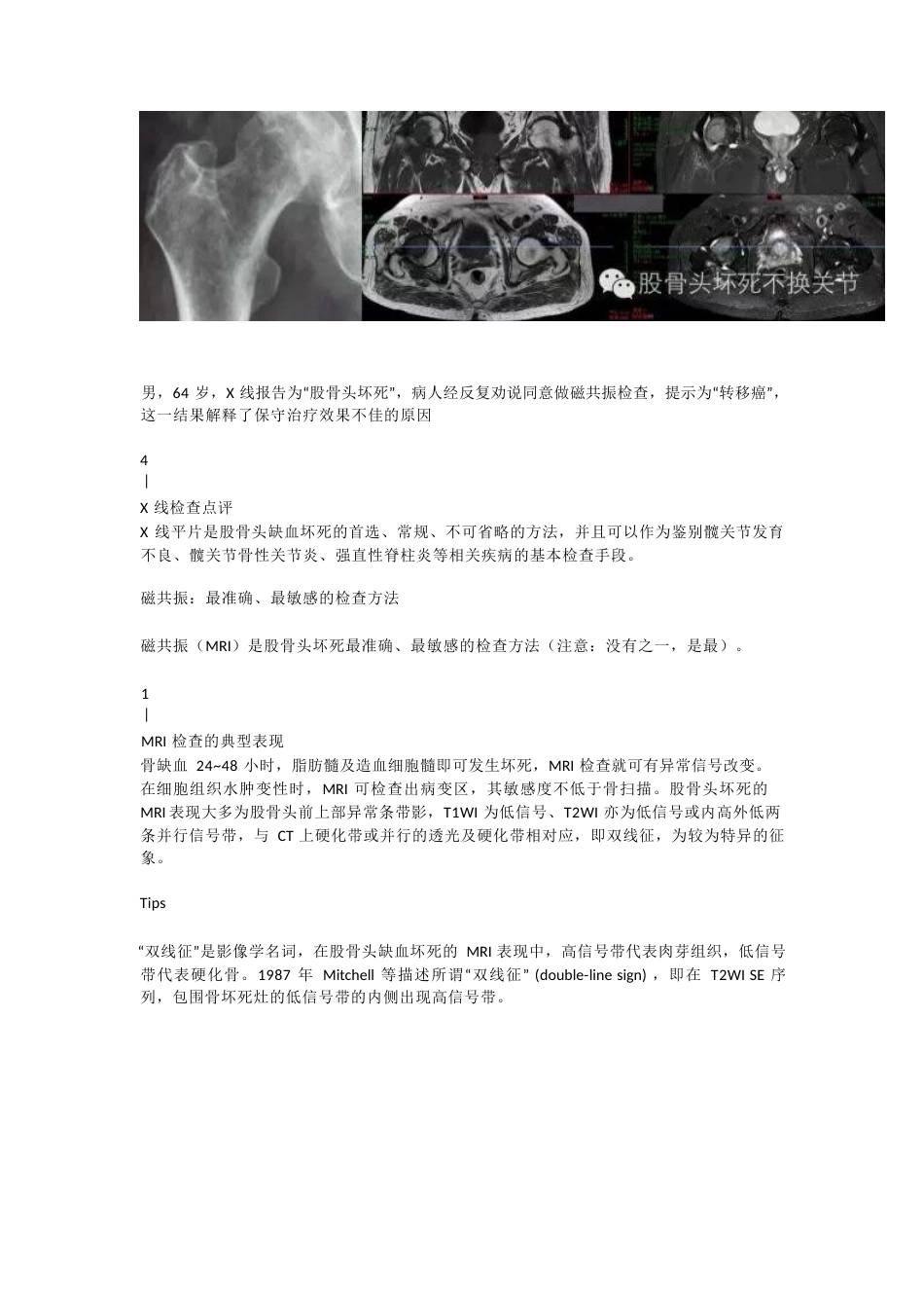 股骨头坏死应该怎样做检查(2)_第4页