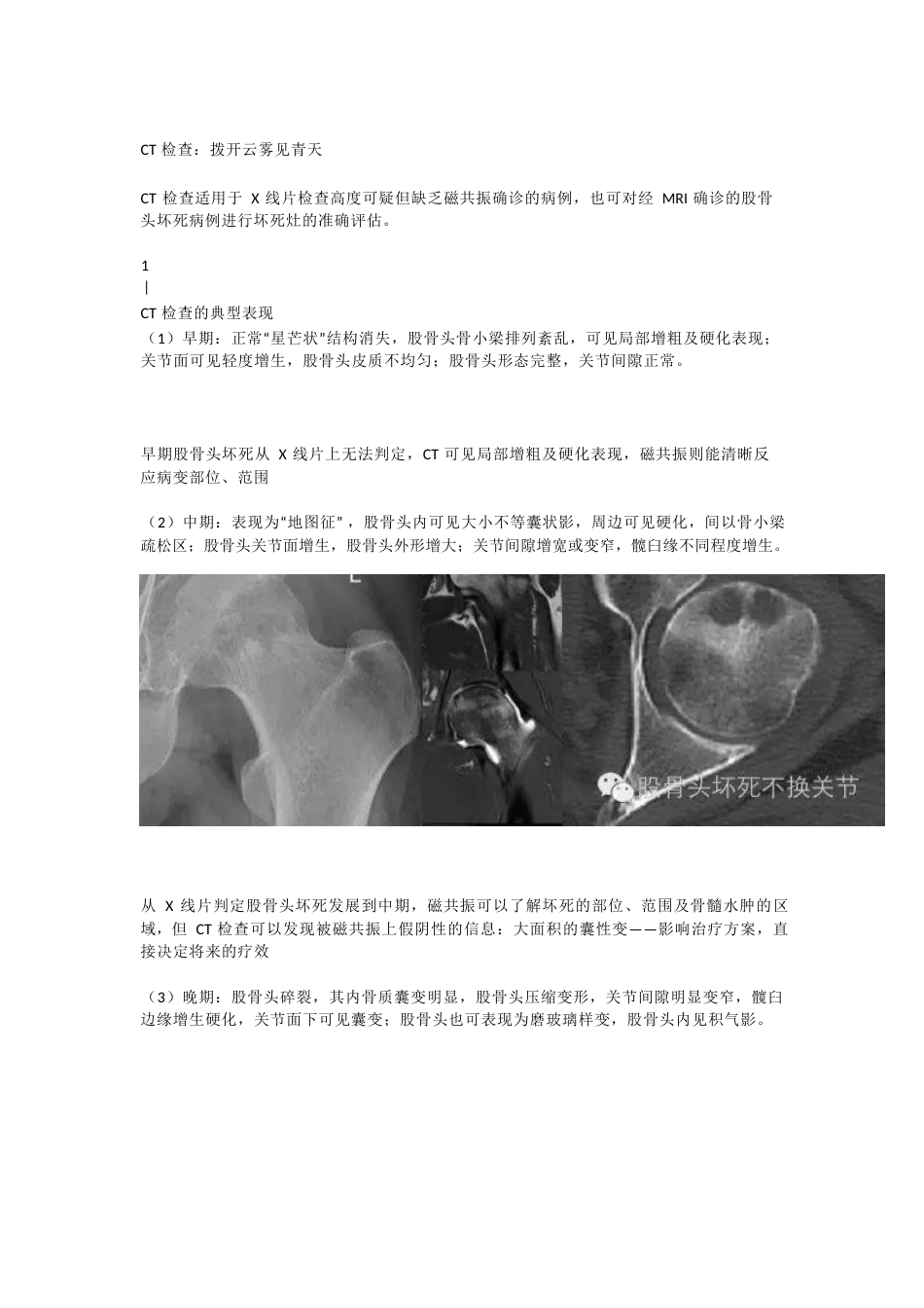 股骨头坏死应该怎样做检查(2)_第9页