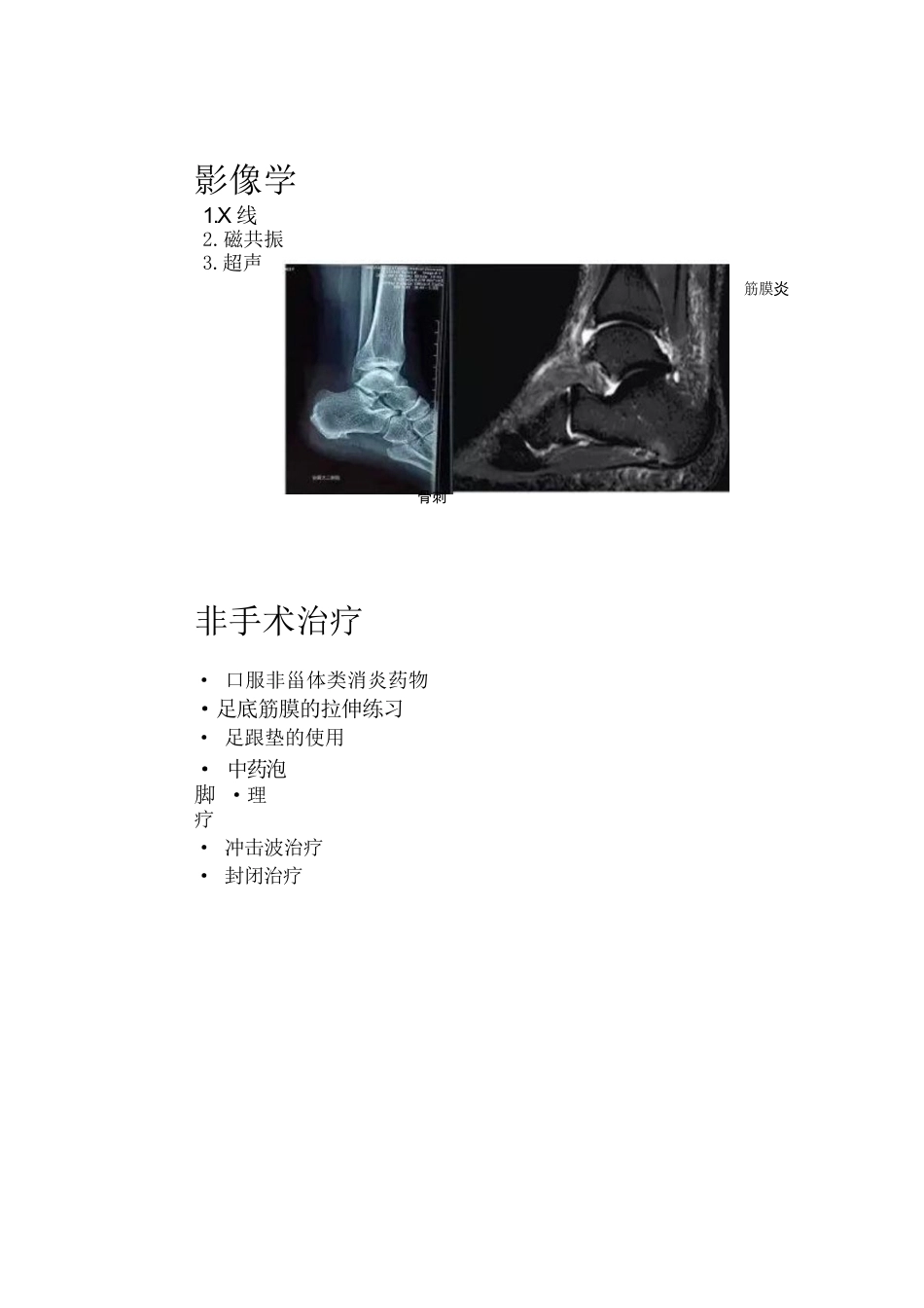 椎体终板炎(2)_第2页