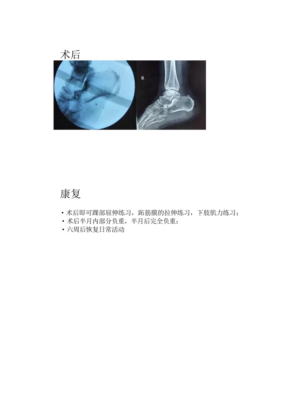 椎体终板炎(2)_第5页
