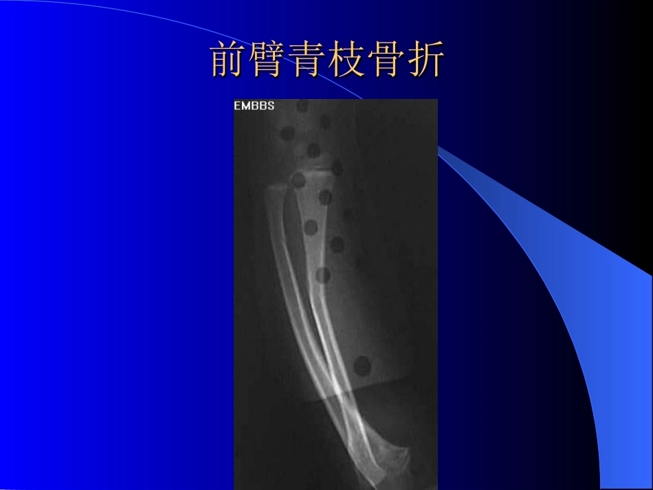 骨科常见疾病的X线表现(2)_第15页
