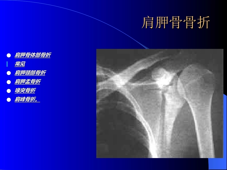 骨科常见疾病的X线表现(2)_第4页