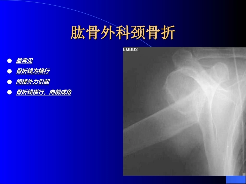 骨科常见疾病的X线表现(2)_第7页