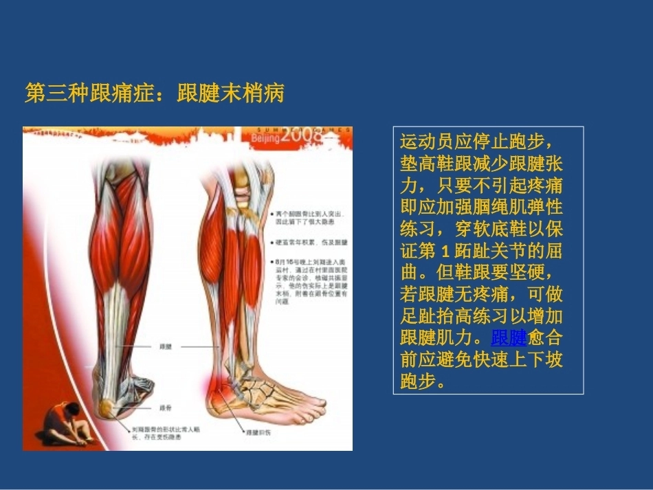 跟痛症课件(2)_第13页