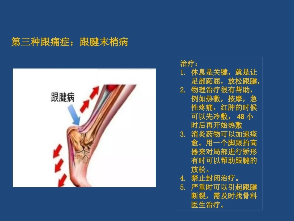 跟痛症课件(2)_第14页