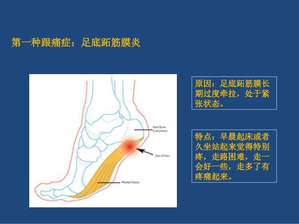 跟痛症课件(2)_第3页