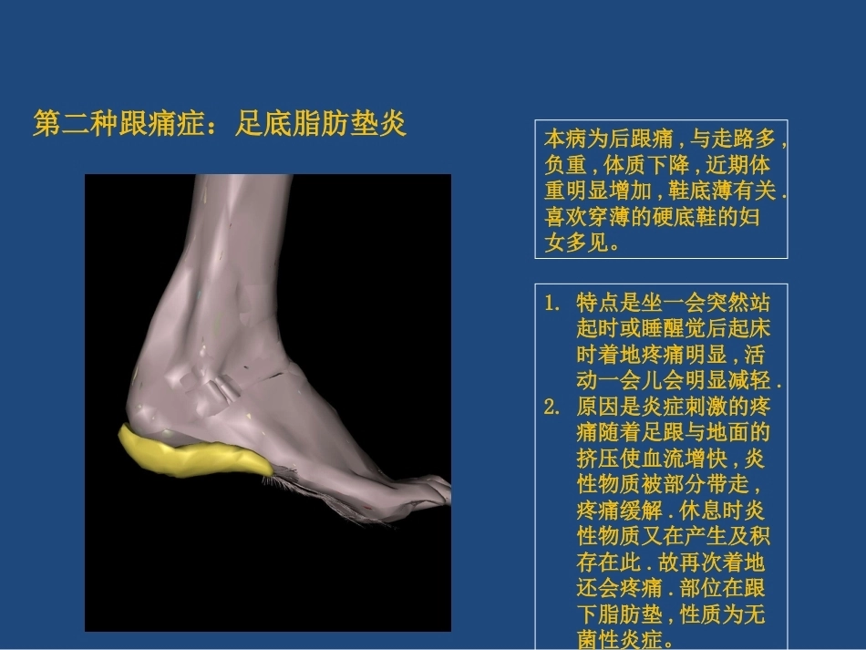 跟痛症课件(2)_第9页