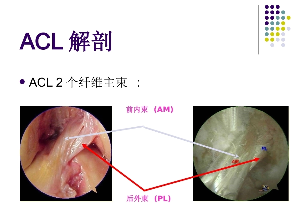 膝关节前交叉韧带损伤诊断与治疗(2)_第4页