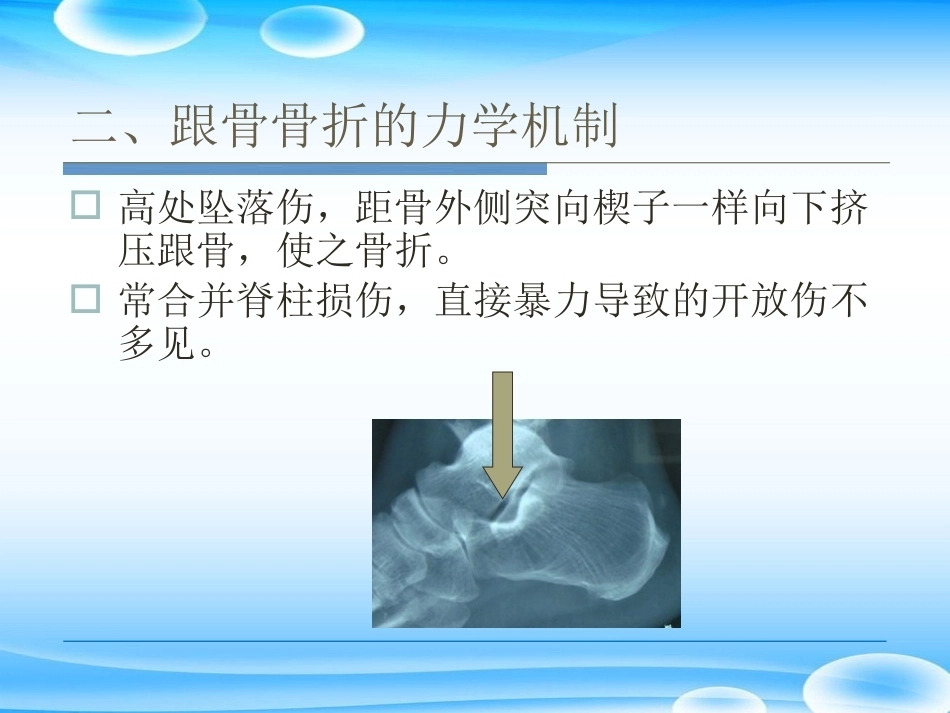 跟骨骨折ORIF的技巧PPT课件(2)_第9页