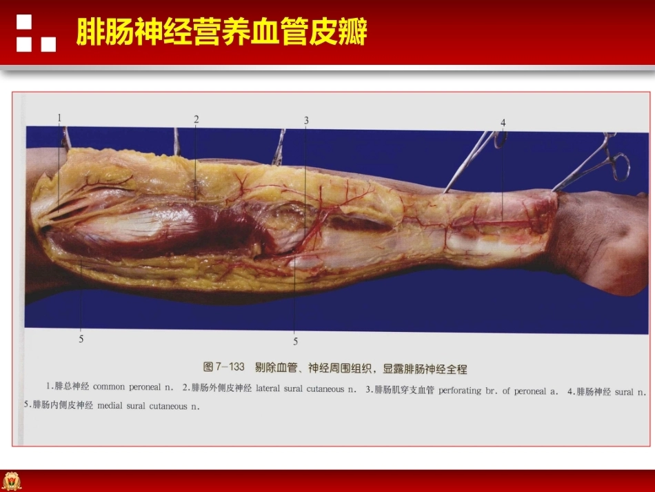带蒂皮瓣转移修复足踝部创面(2)_第10页
