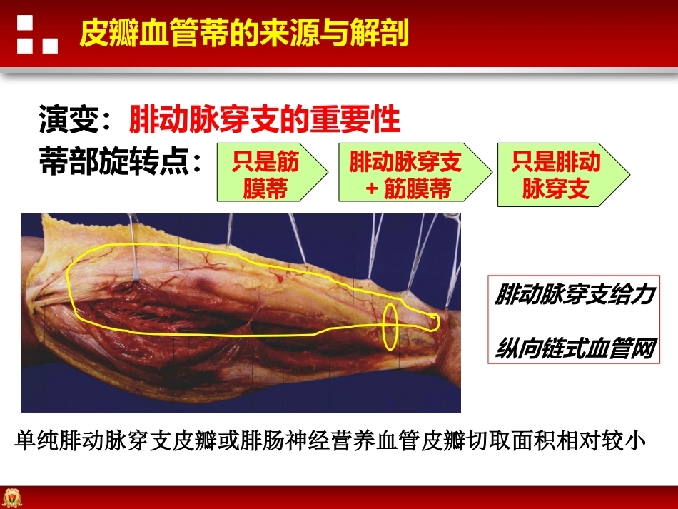 带蒂皮瓣转移修复足踝部创面(2)_第13页