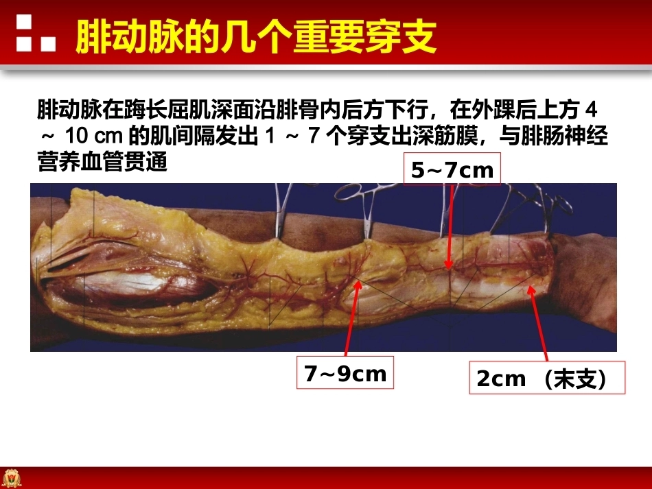 带蒂皮瓣转移修复足踝部创面(2)_第14页