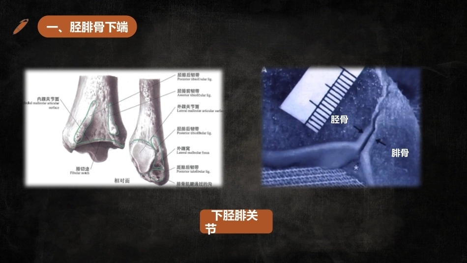 足踝解剖3_第6页