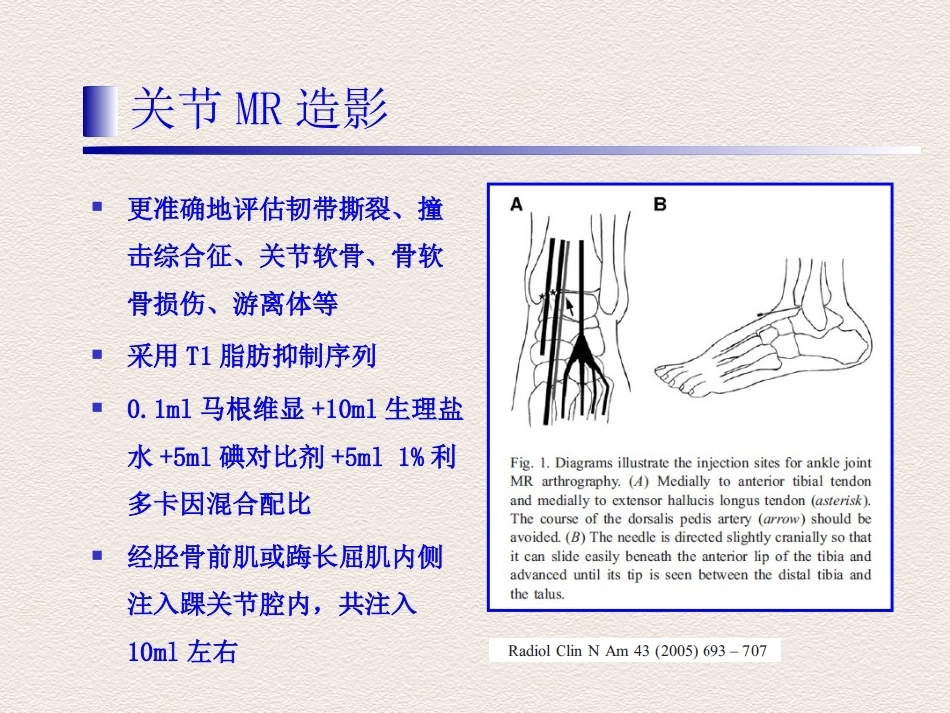 踝关节运动损伤MR诊断(4)_第12页