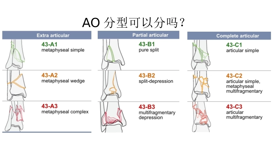 胫骨干合并后踝骨折的处理(4)_第5页