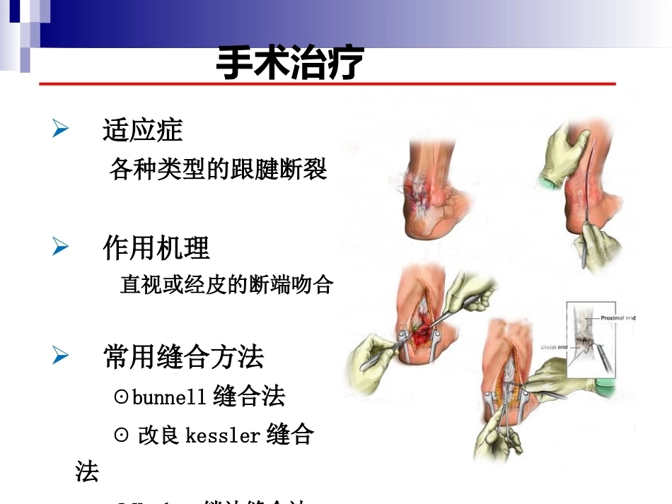 急性跟腱中部断裂的诊治(4)_第10页