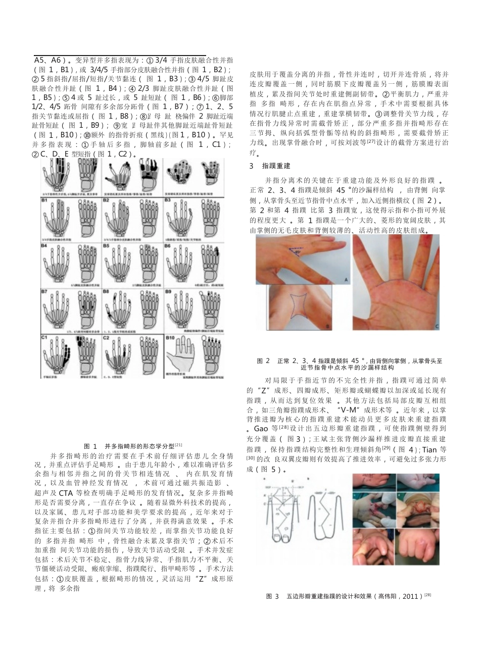 先天性并指畸形诊疗的专家共识(12)_第3页