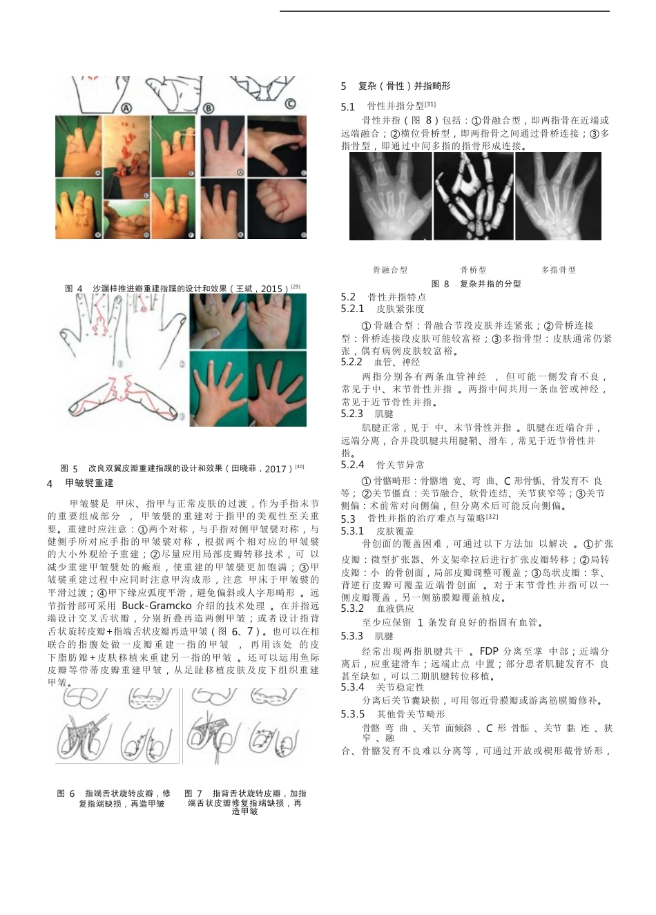 先天性并指畸形诊疗的专家共识(12)_第4页