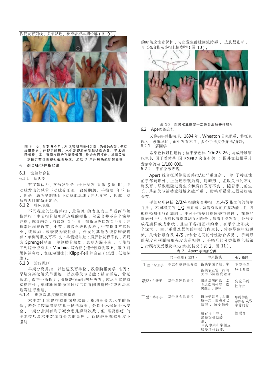 先天性并指畸形诊疗的专家共识(12)_第5页