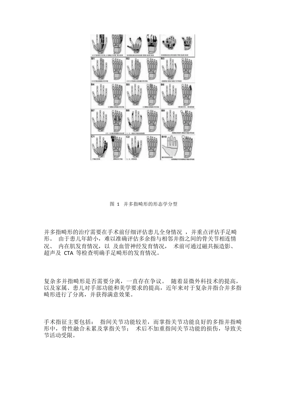先天性并指畸形诊疗专家共识(13)_第4页