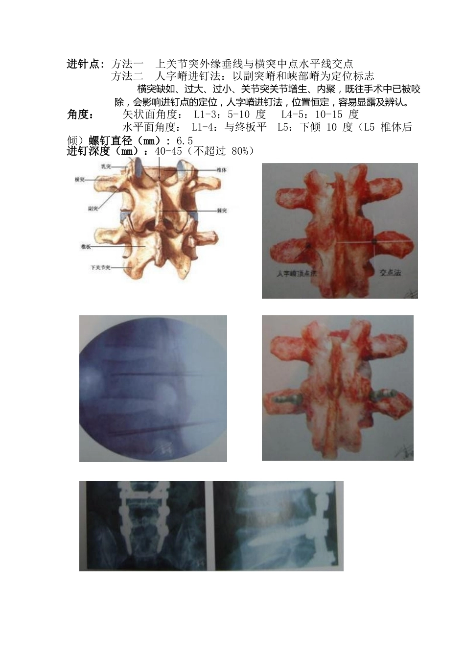 最全面的椎弓根钉打法(27)_第5页