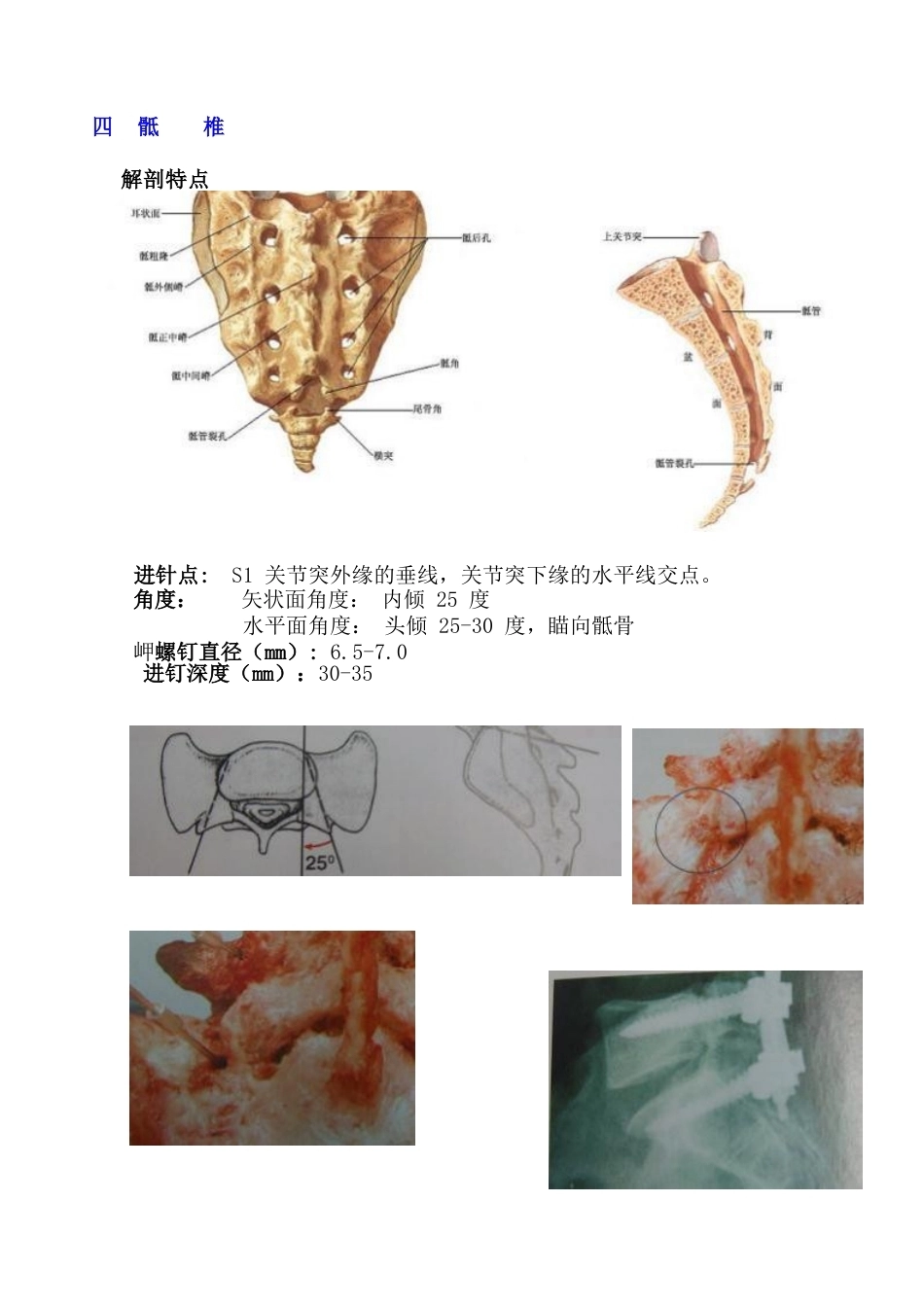最全面的椎弓根钉打法(27)_第6页