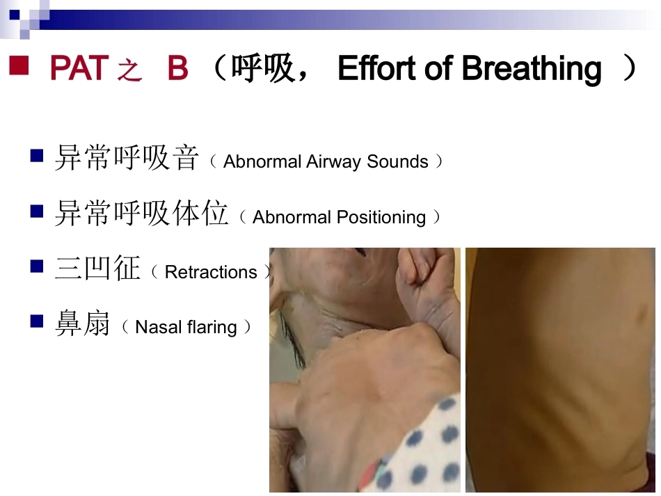 儿科急诊评估_第10页
