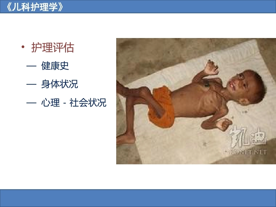 儿科护理学之营养障碍疾病患儿的护理_第14页