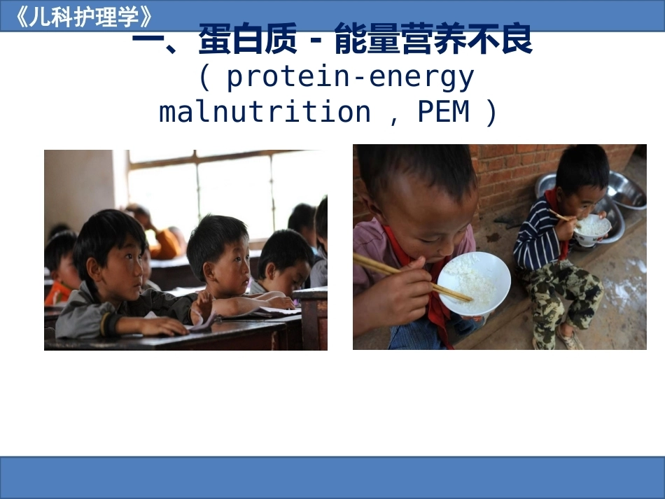 儿科护理学之营养障碍疾病患儿的护理_第5页