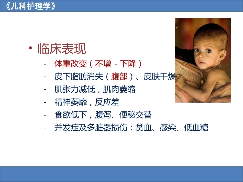 儿科护理学之营养障碍疾病患儿的护理_第9页