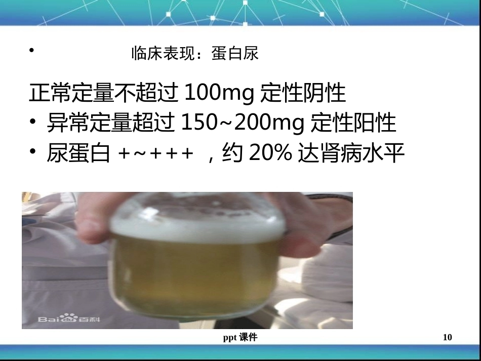 儿科急性肾小球肾炎ppt课件_第10页
