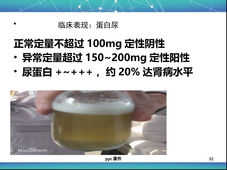 儿科急性肾小球肾炎ppt课件_第12页