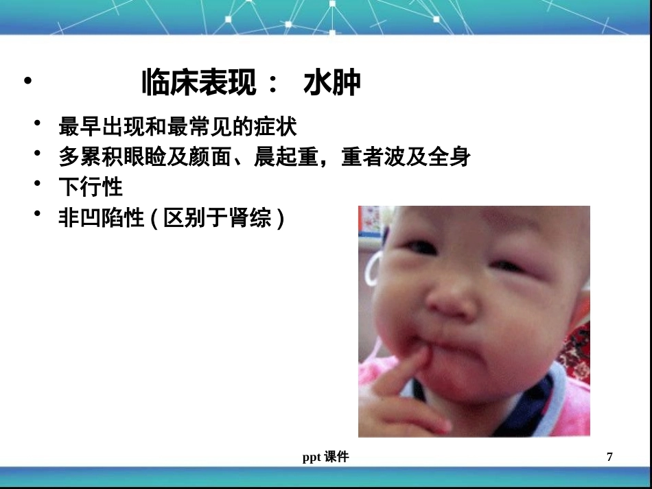 儿科急性肾小球肾炎ppt课件_第7页