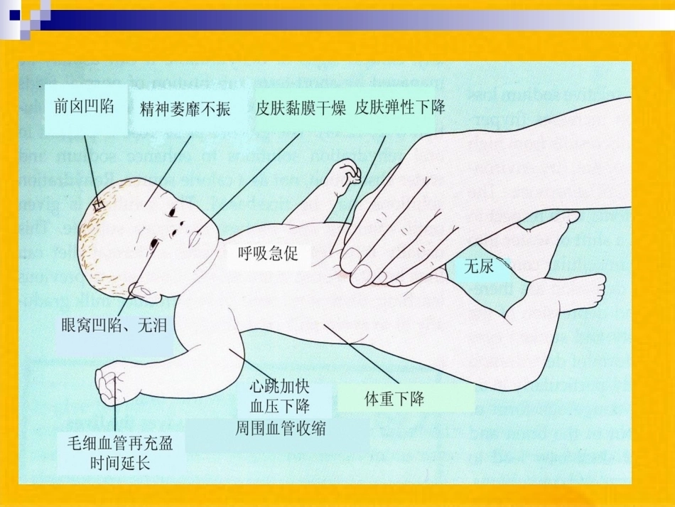 儿科疾病诊治原则液体疗法_第11页