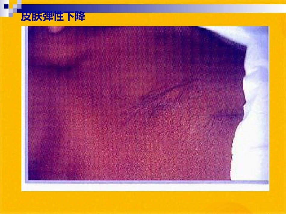 儿科疾病诊治原则液体疗法_第12页