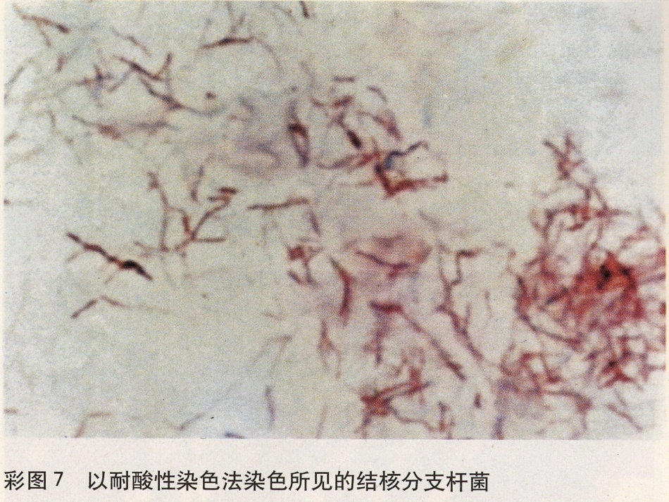 儿科教学课件结核病总论_第10页