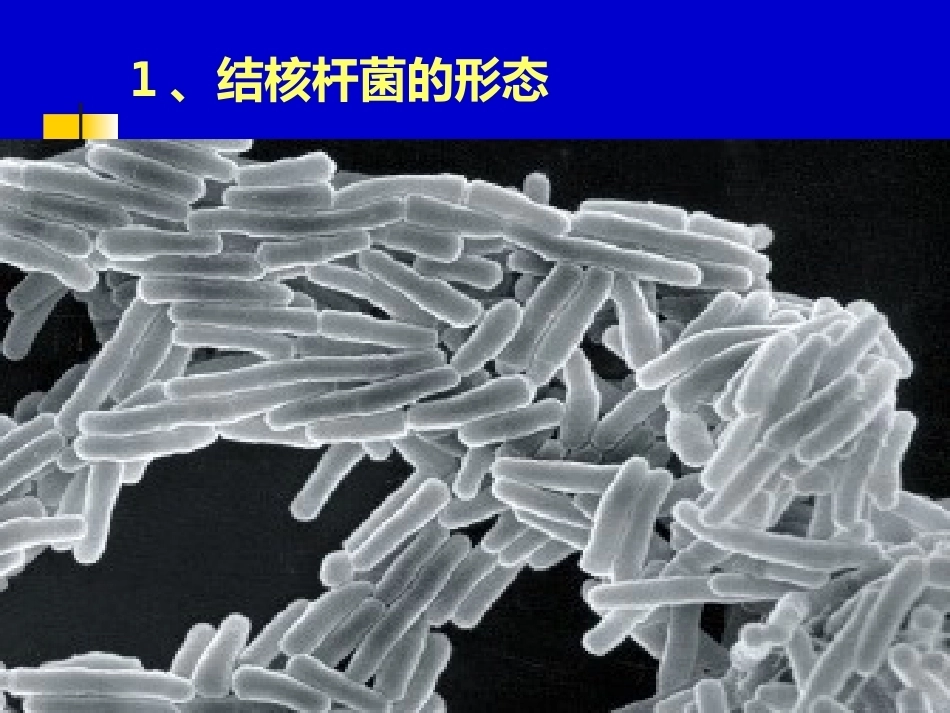儿科教学课件结核病总论_第11页