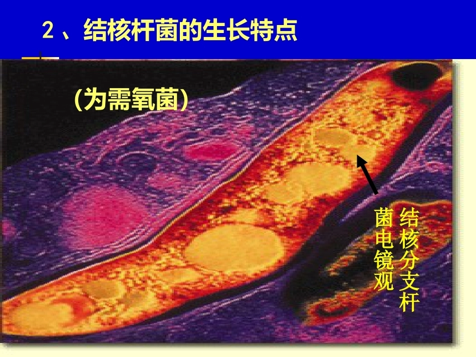 儿科教学课件结核病总论_第12页