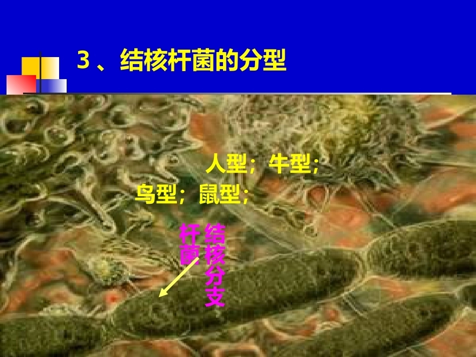 儿科教学课件结核病总论_第13页