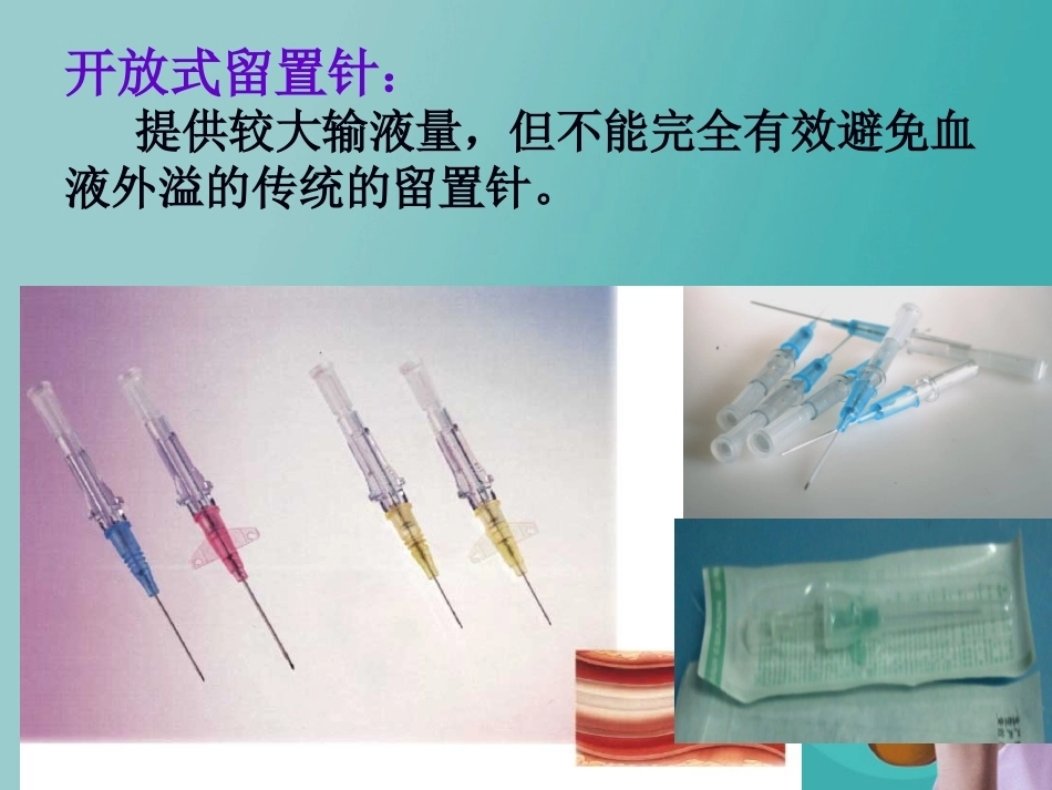 儿科静脉留置针操作与维护2_第9页