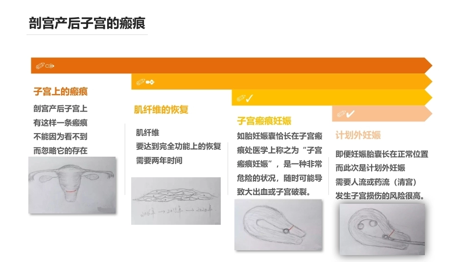产后即时避孕 PPT课件_第13页