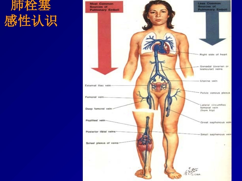 D二聚体及肺栓塞的诊断与治疗_第10页