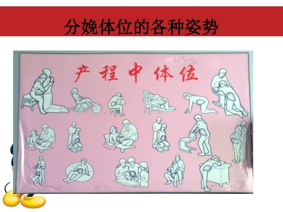 产程观察与体位管理自由体位分娩_第9页