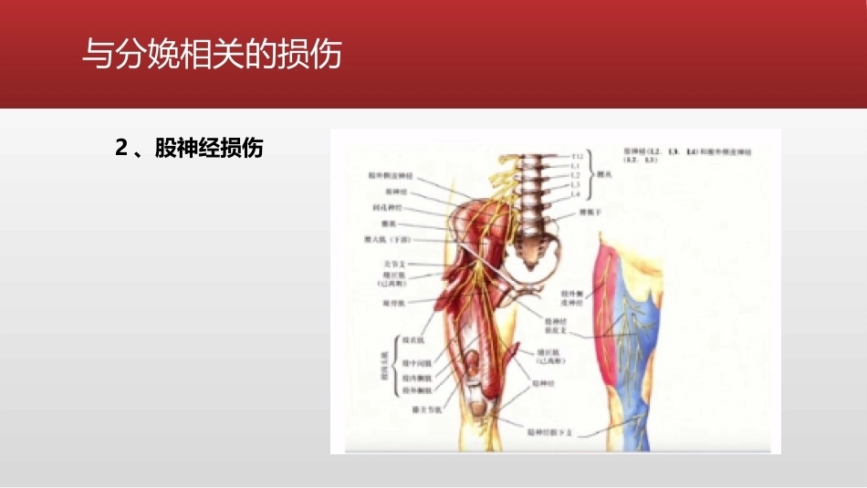 避免产科相关的下肢神经损伤的处理_第10页