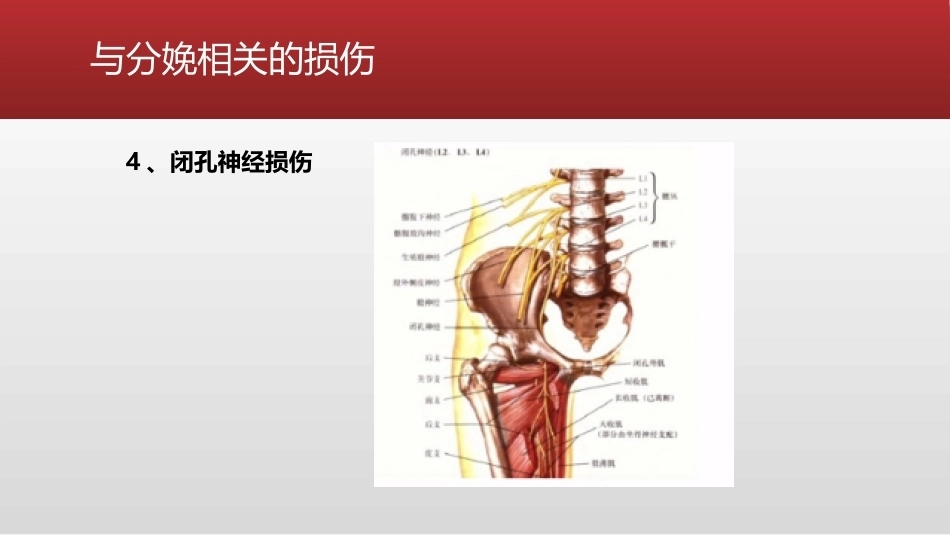 避免产科相关的下肢神经损伤的处理_第14页