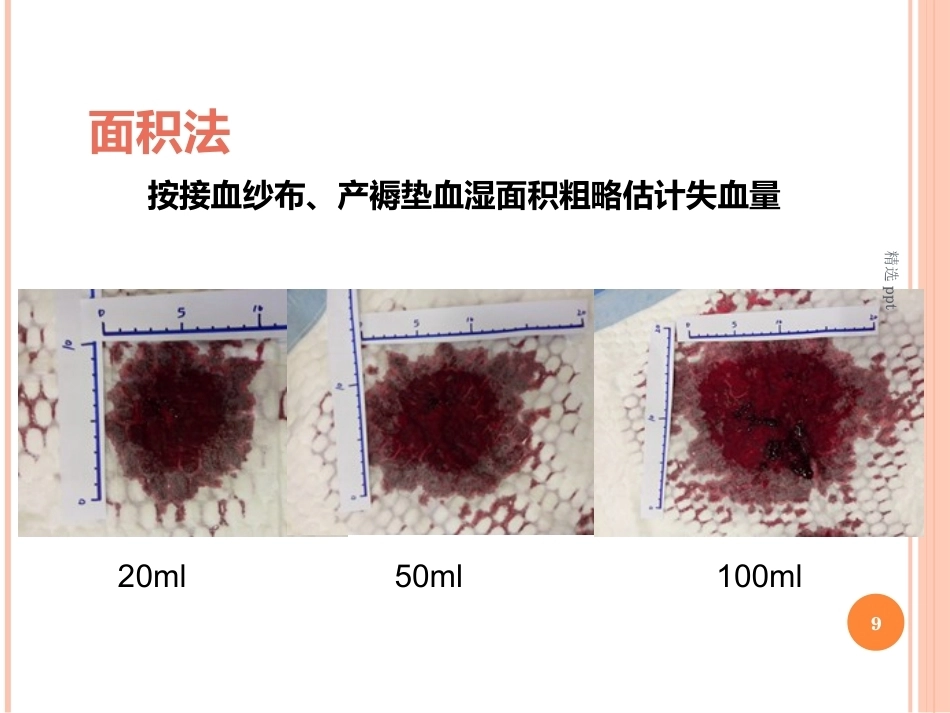 产后出血之出血量评估_第9页
