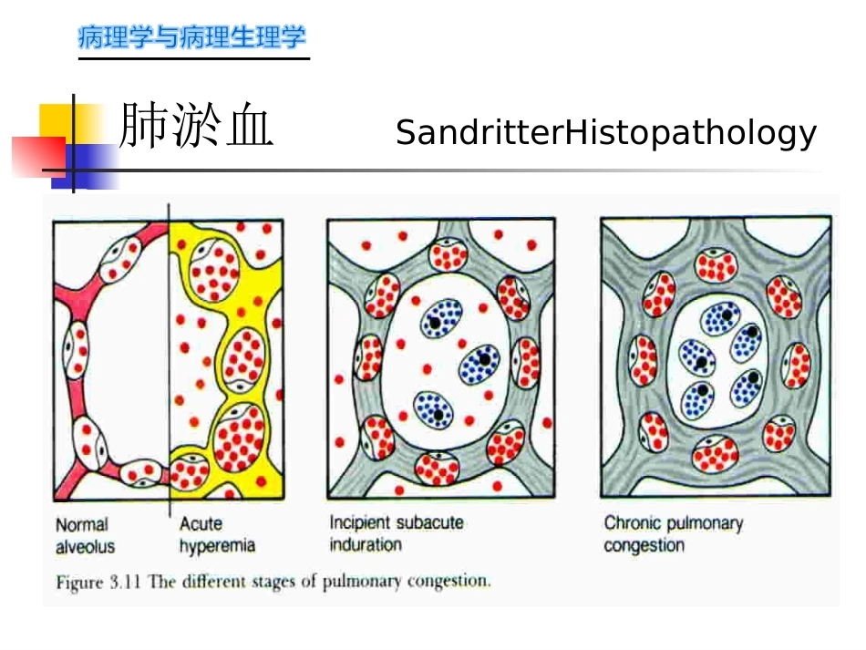 局部血液循环障碍病理学_第12页