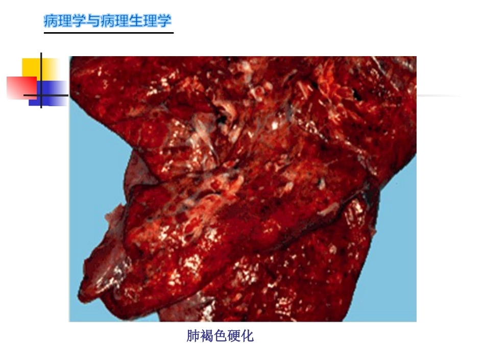 局部血液循环障碍病理学_第13页