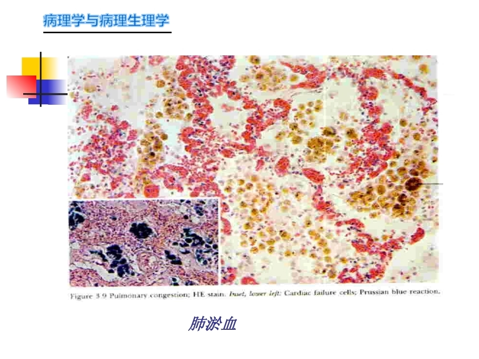 局部血液循环障碍病理学_第14页